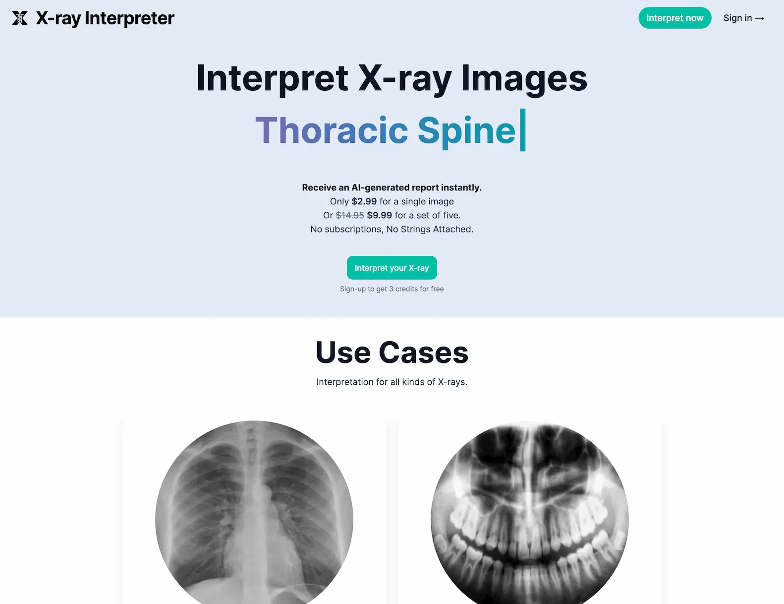X-ray Interpreter - AI-generated report instantly screenshot